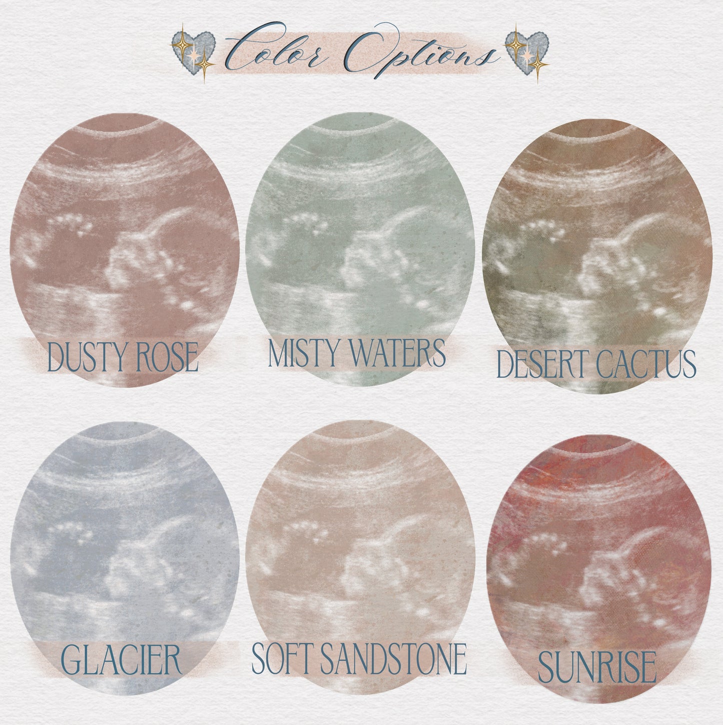 Custom Sonogram Print