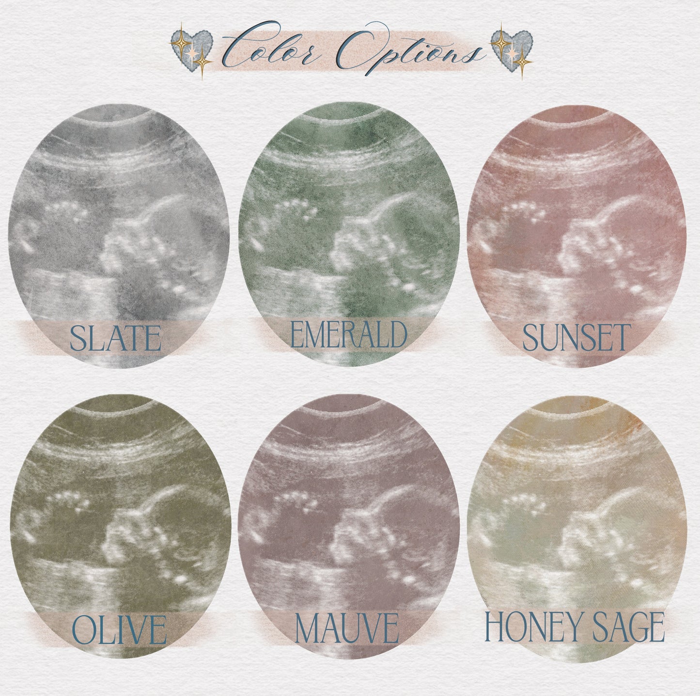 Custom Sonogram Print