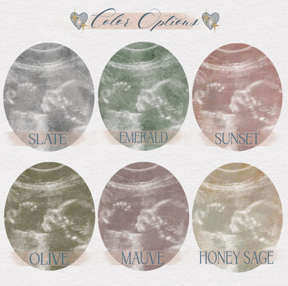 Custom Sonogram Print
