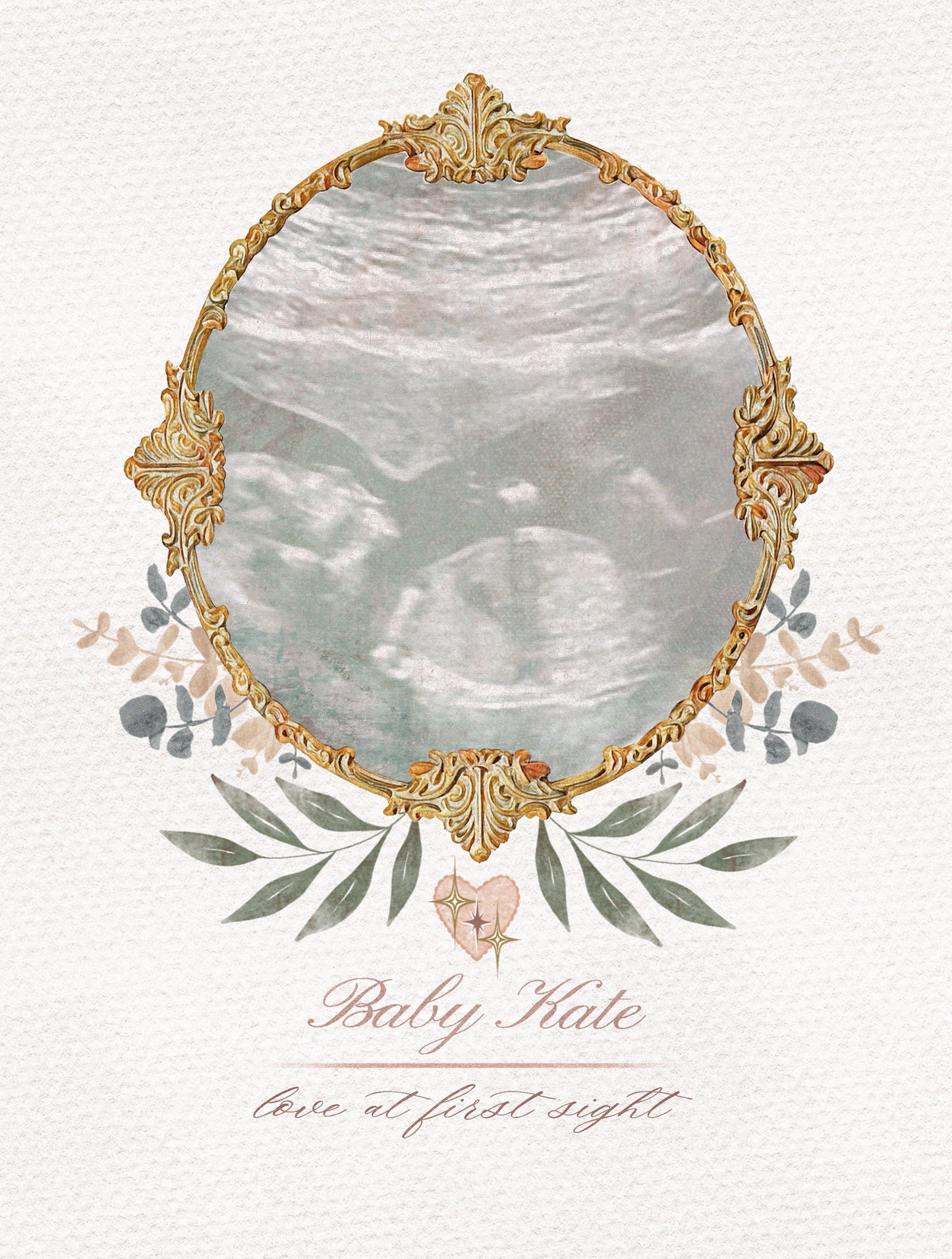 Custom Sonogram Print