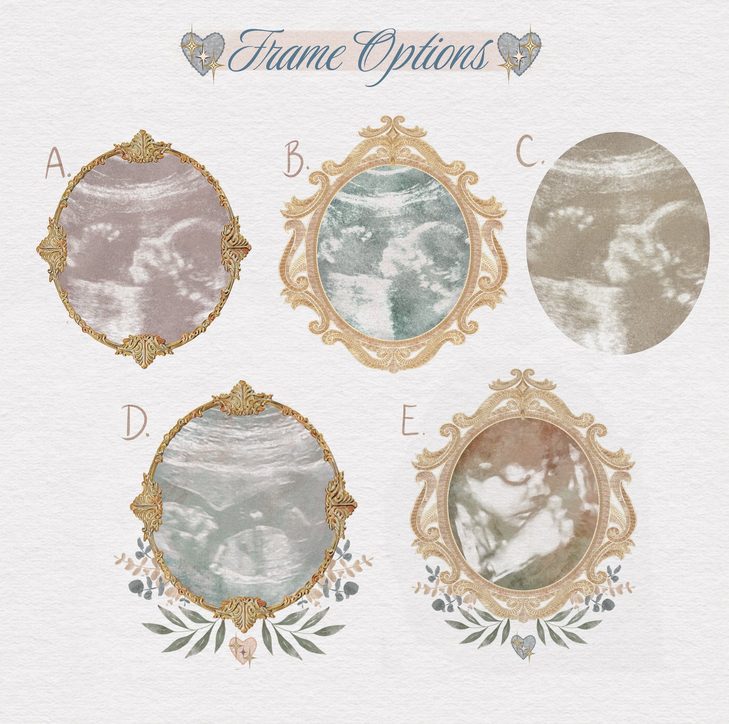 Custom Sonogram Print